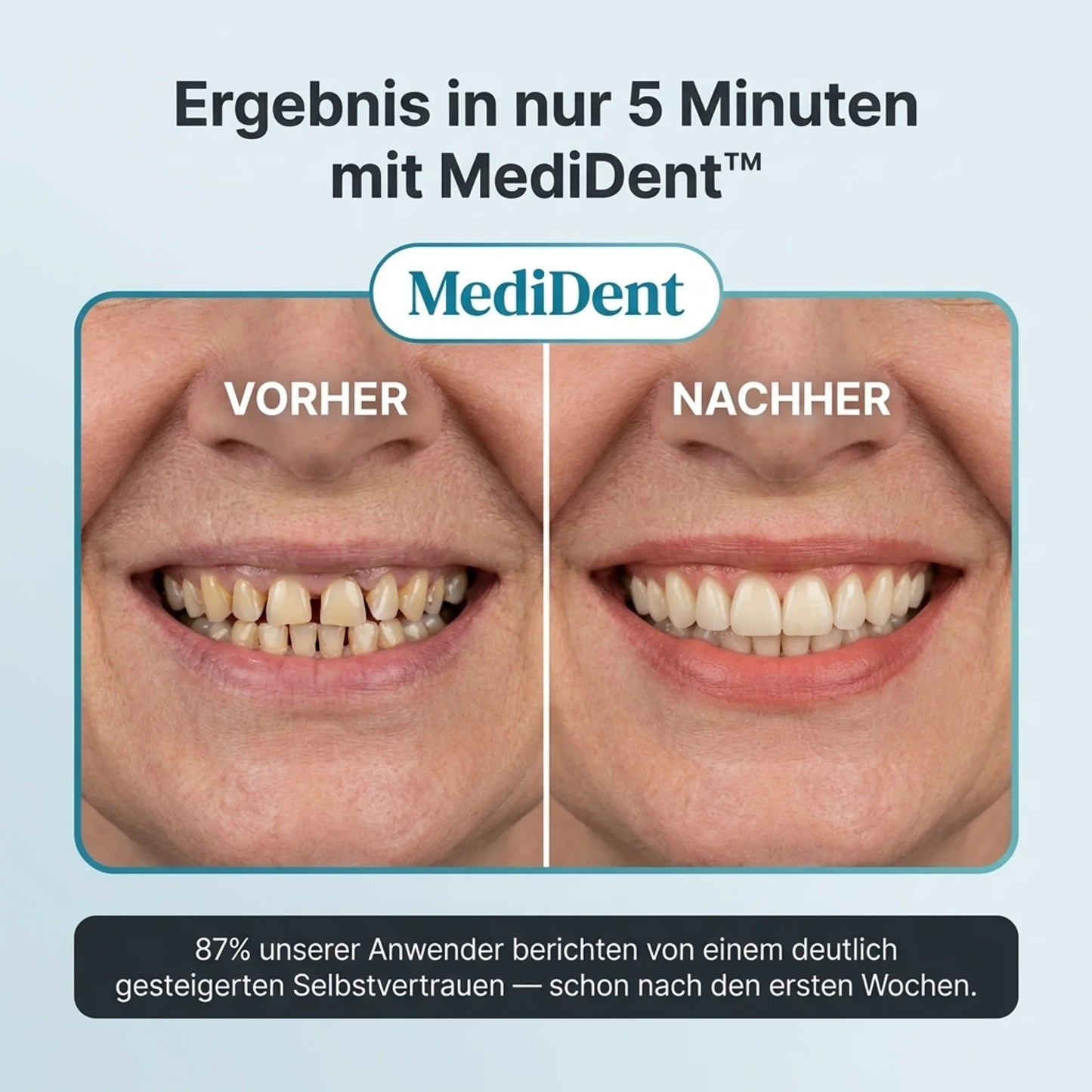 MediDent Sofort-Zahnprothese