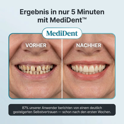 MediDent Sofort-Zahnprothese